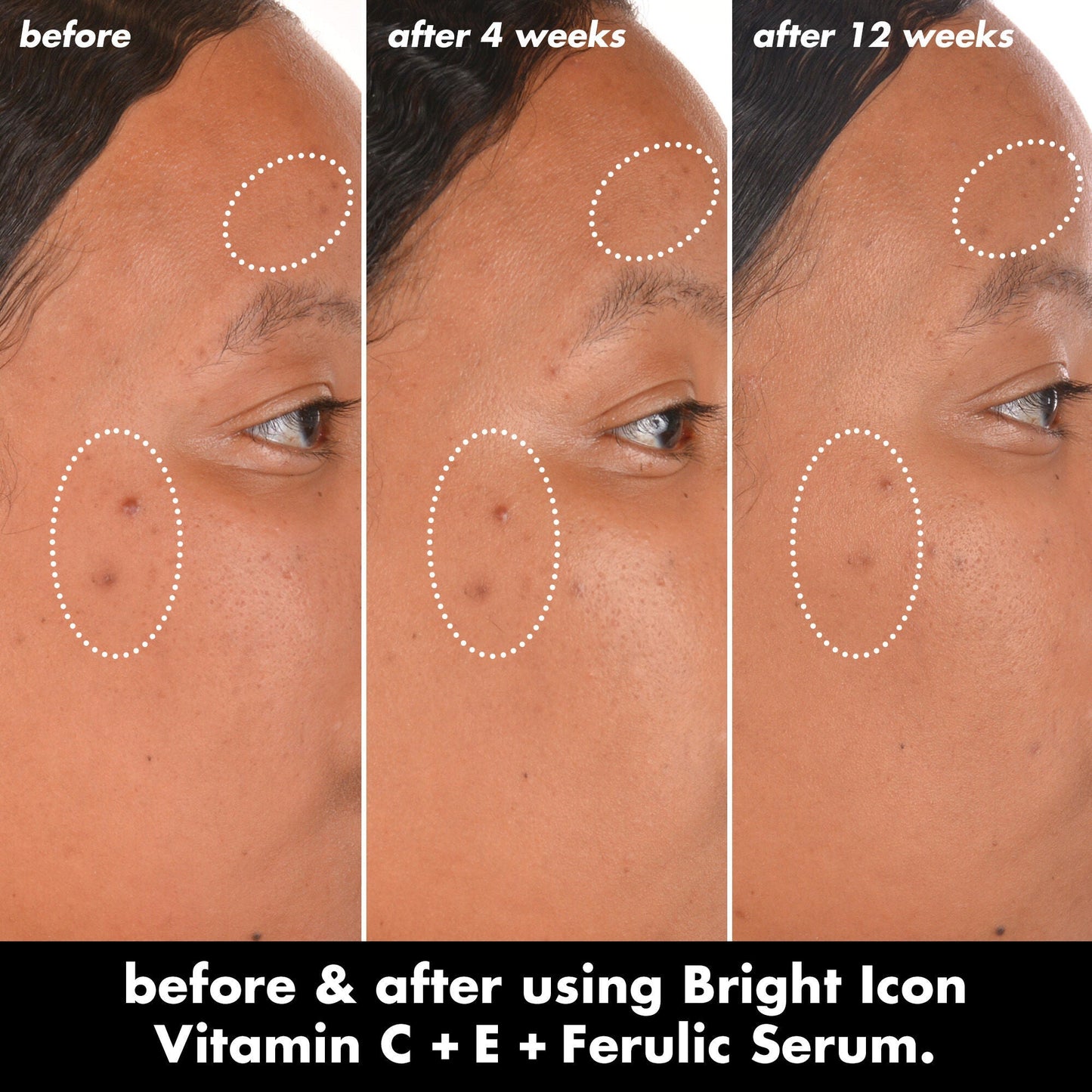bright-icon-vitamin-c-e-ferulic-serum-k7 0226_EDU_BrightIconVitC_BA_Chanel_TRIPTYCH_c58f2fc8-209d-414f-9ba3-666a07a94887.jpg