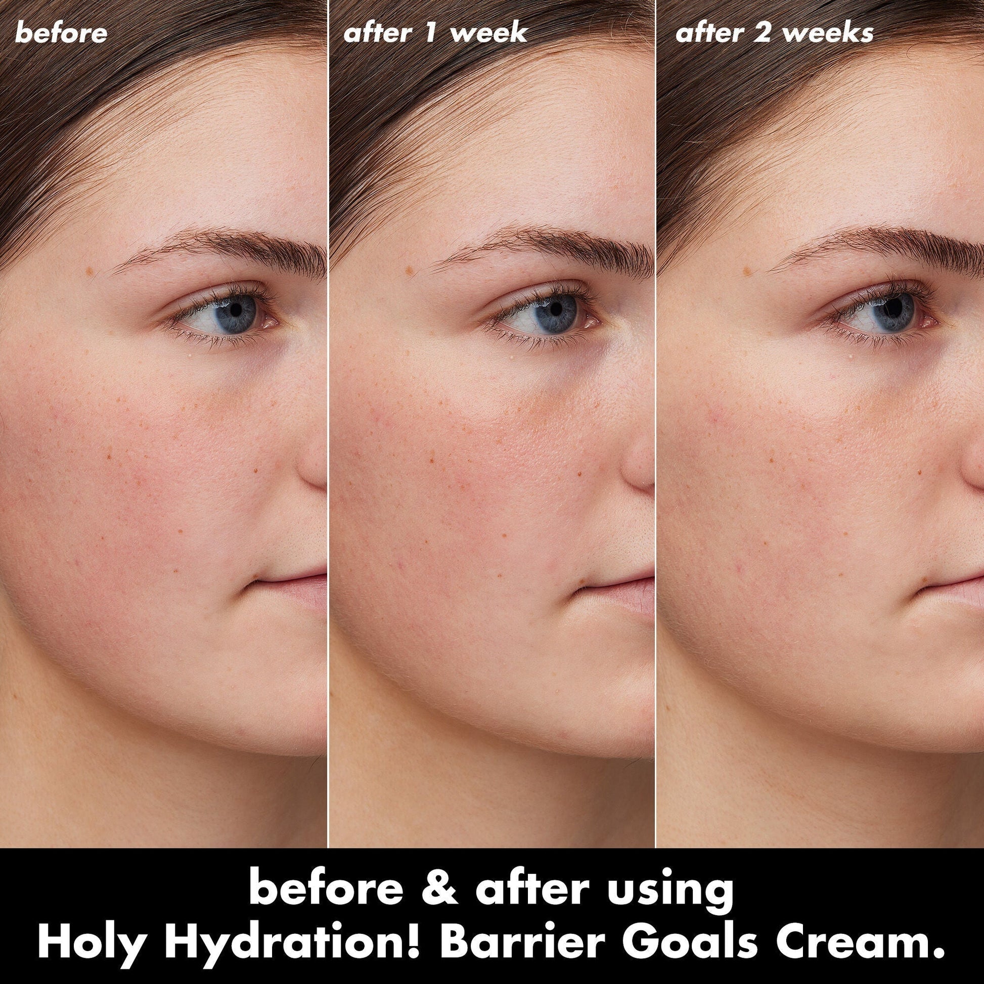 holy-hydration-barrier-goals-cream-t9 0226_EDU_HHBarrierGoalsCream_B_A_Zoe_TRYPTICH_710f5249-3a6b-41fd-89e4-817294dd9258.jpg