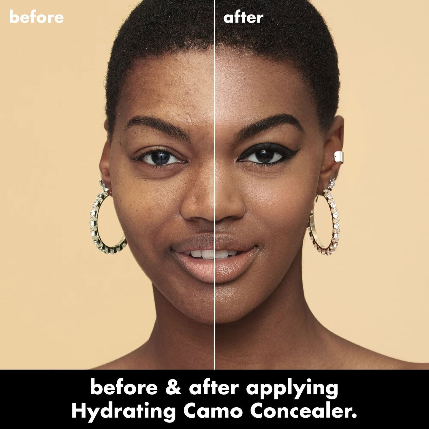 hydrating-camo-concealer-s8 0226_EDU_HydratingCamoConcelaer_BA_AshleyKaresh_20_1_d8499bbf-0e91-4173-b5e2-75127caf83a3.jpg
