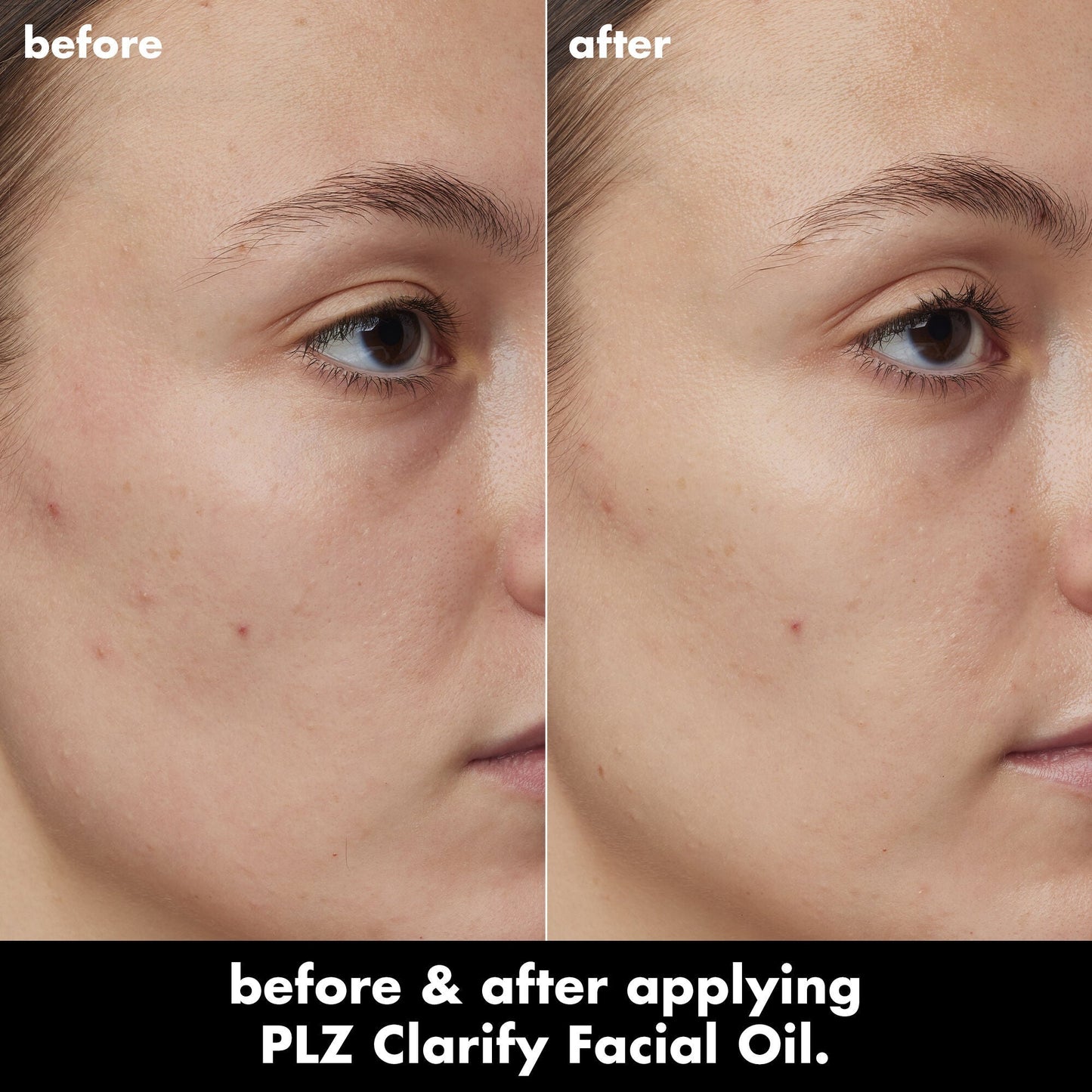 plz-clarify-facial-oil-g5 0326_EDU_PlzClarify_BA_Kelly.jpg