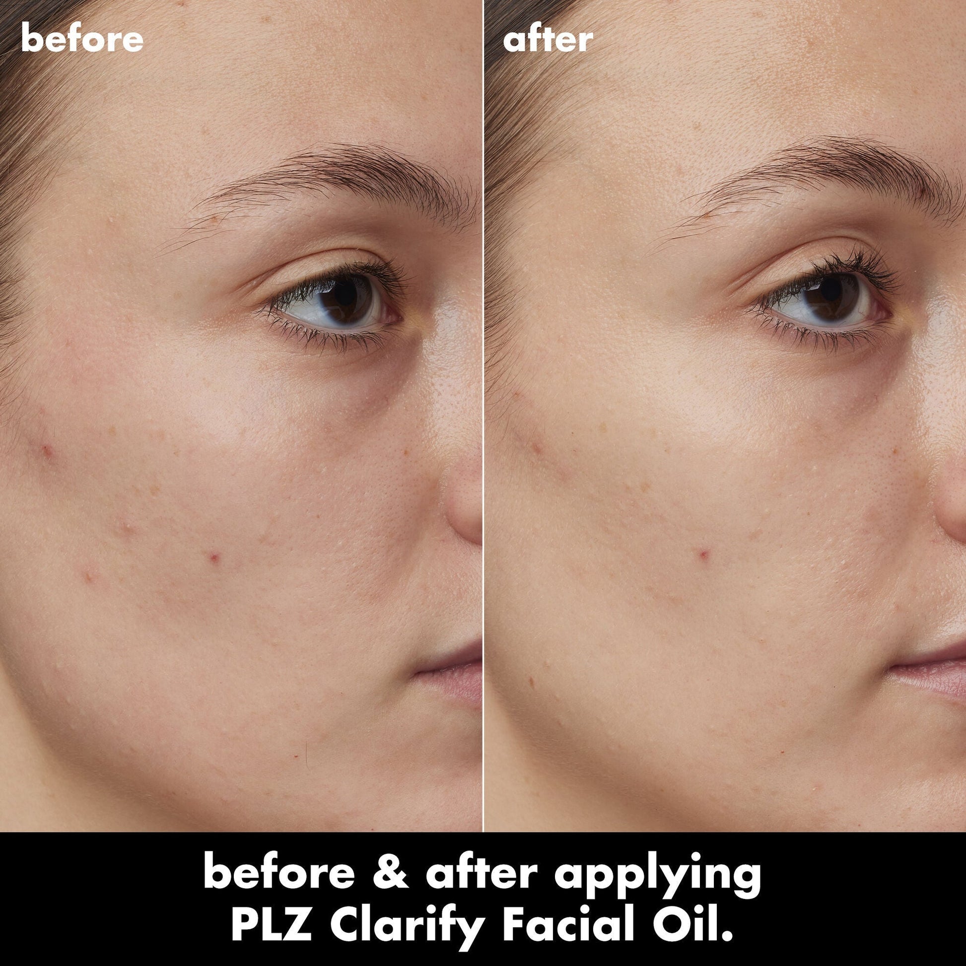 plz-clarify-facial-oil-g5 0326_EDU_PlzClarify_BA_Kelly.jpg