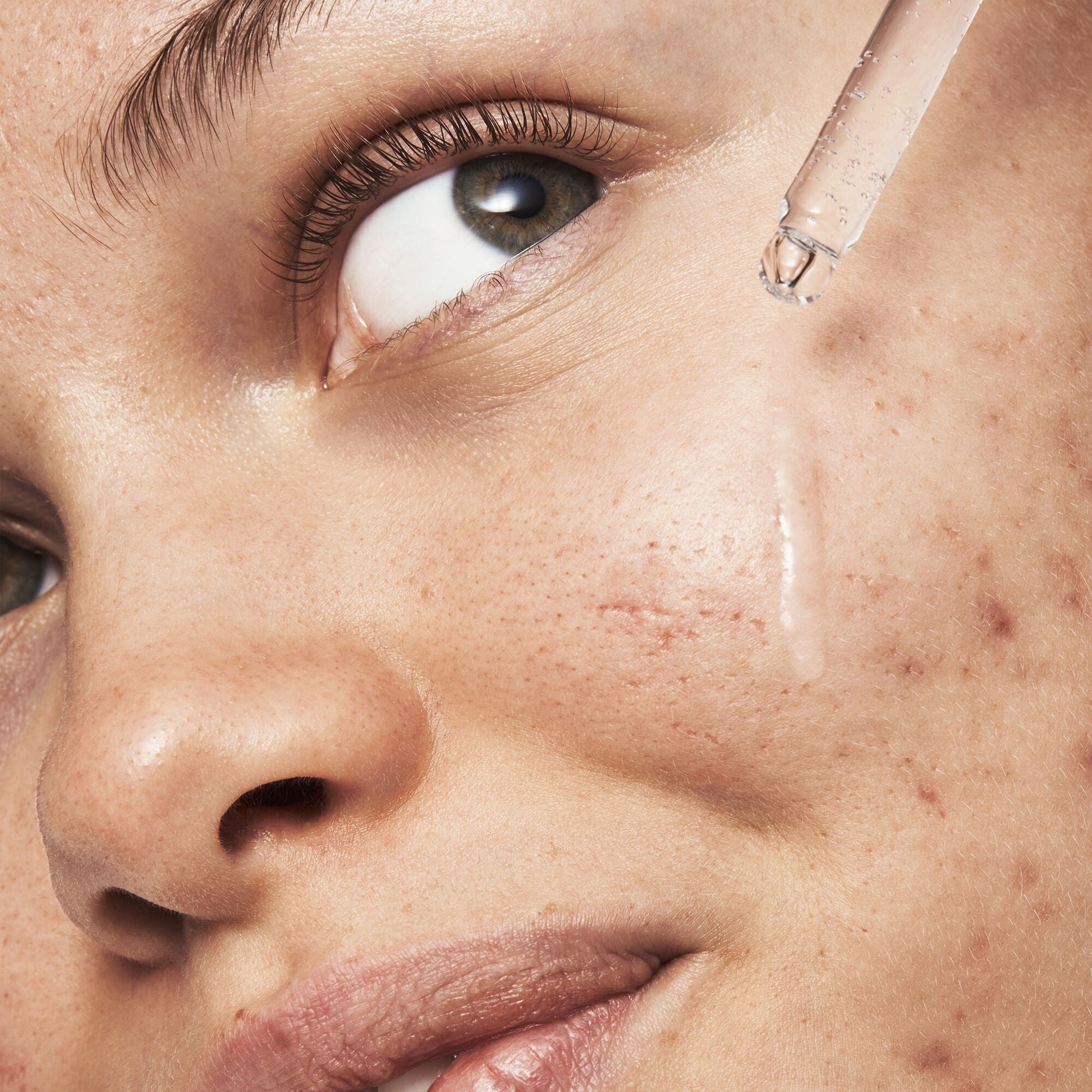 blemish-breakthrough-triple-acid-resurfacing-serum-a0 121321_Marley-Acne-Regimen_0254_FINAL_IGF.jpg