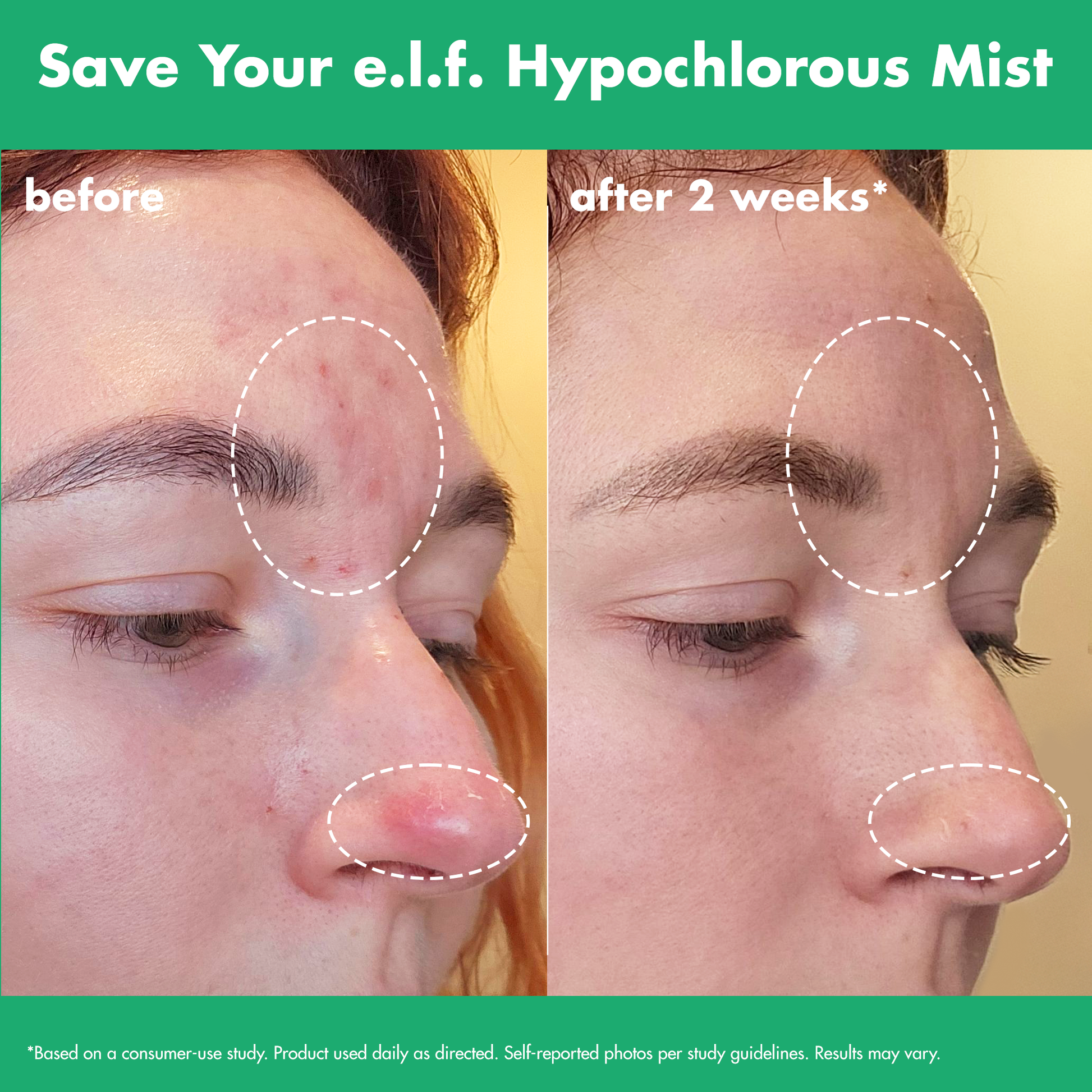 save-your-e-l-f-hypochlorous-mist-w8 FA26_EDUCATION_SAVEYOURELF_USAGE_BA1_WITHOUT_CLAIMS.png