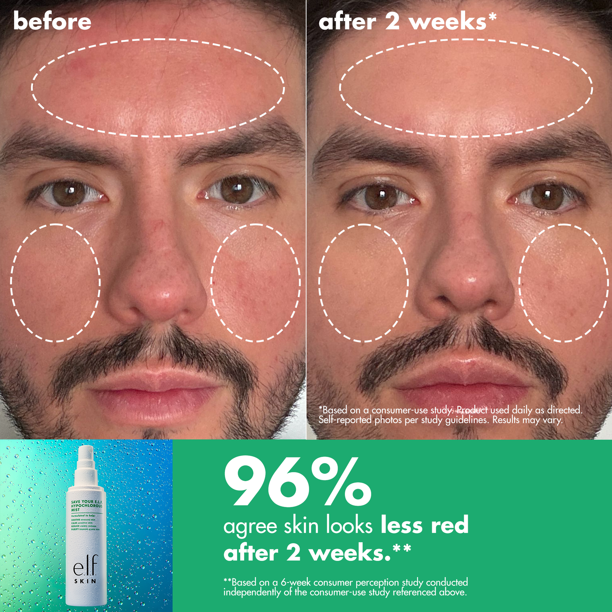 save-your-e-l-f-hypochlorous-mist-w8 FA26_EDUCATION_SAVEYOURELF_USAGE_BA2_WITH_CLAIMS.png