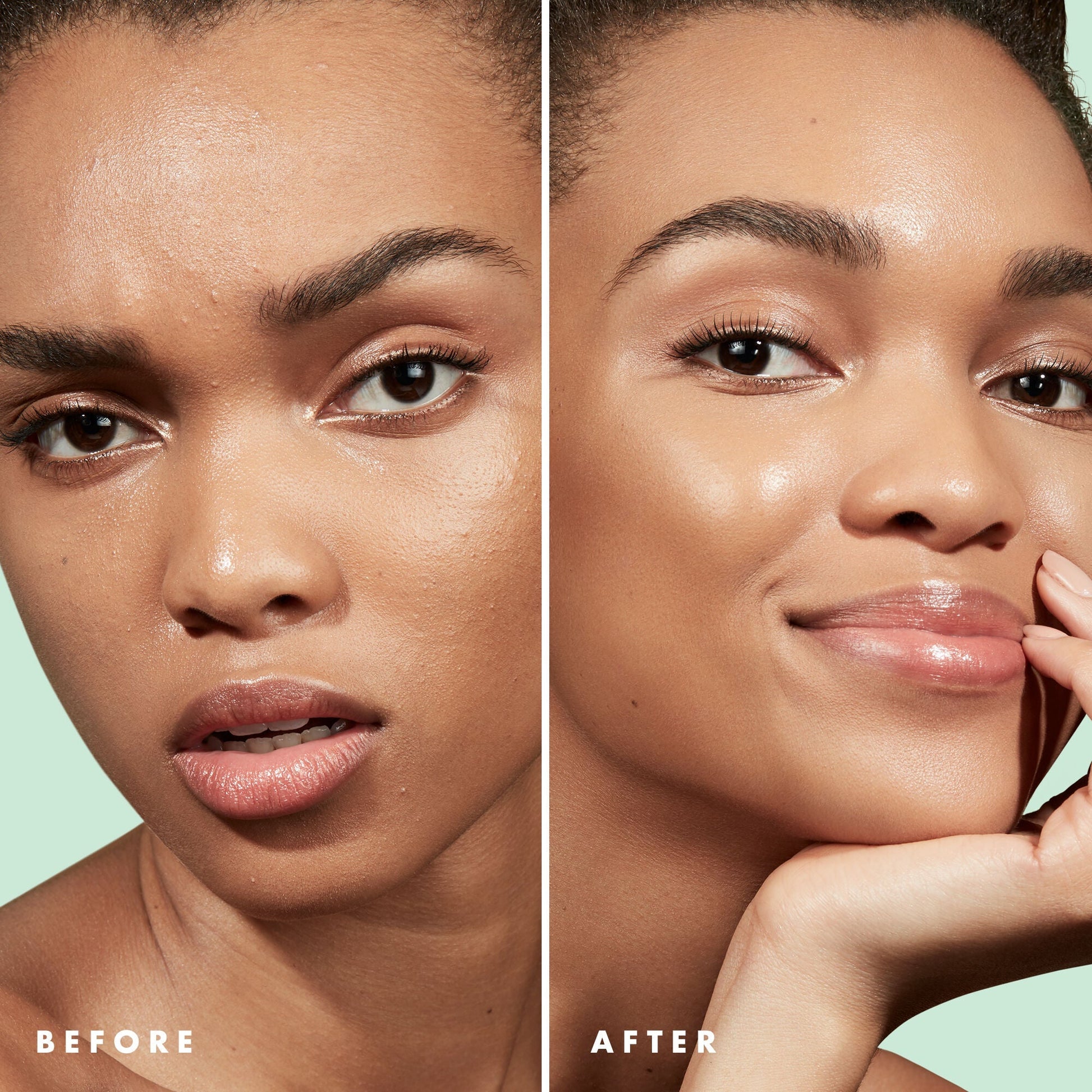 blemish-control-face-primer-large-size-u5 Primer_PP_Before_After_BlemishControl_2000x2000_3774231e-d4e1-49dd-b3d7-a73cbac901fe.jpg